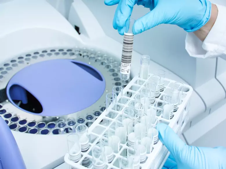 Histopatologia w onkologii