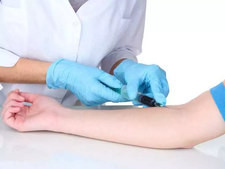 Problemy z krzepnięciem krwi – to może być małopłytkowość. Czym jest i jak ją leczyć?