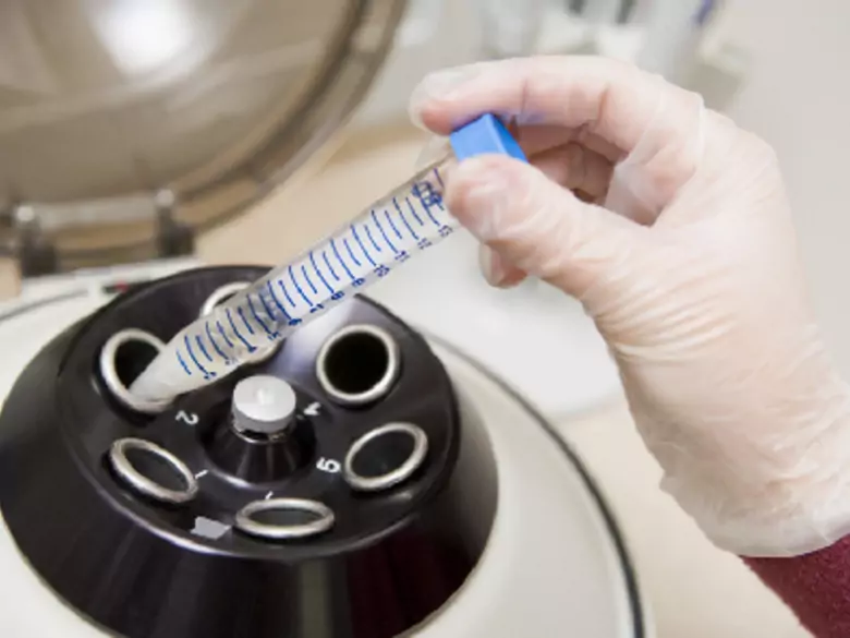 4 października obchodzony jest Międzynarodowy Dzień Onkologii