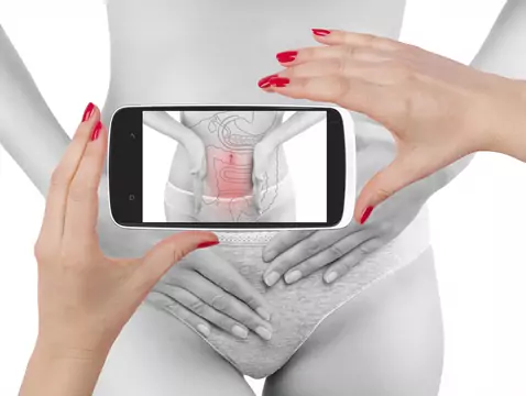 Rak jajników - czy nadal jest tak groźny?