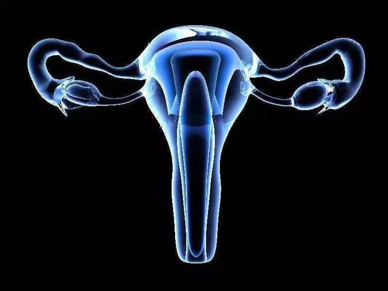 Podział morfologiczny raka jajnika - nowotwory nabłonkowe.