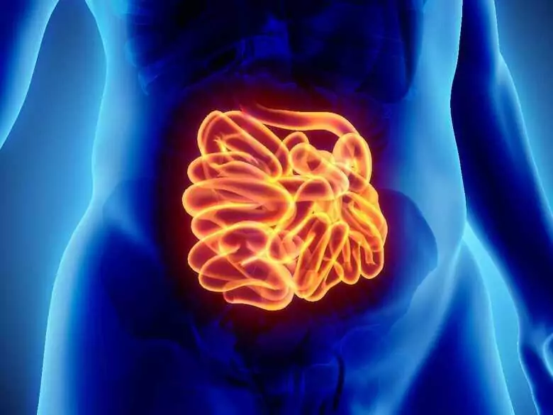 Spożycie syropu fruktozowego a rak jelita grubego