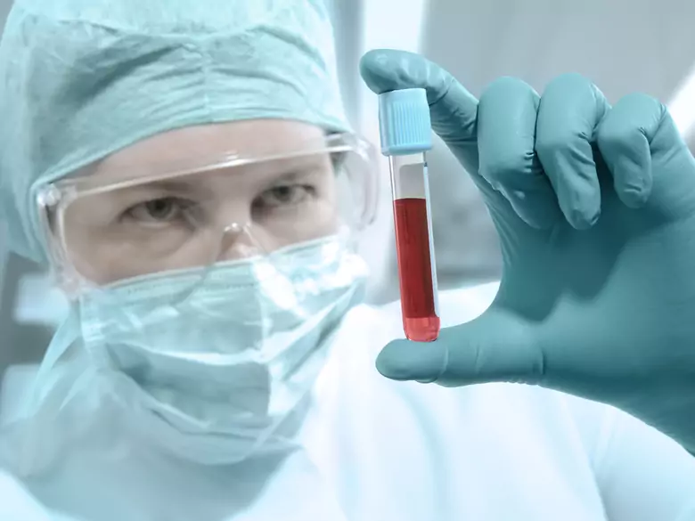 Transplantacja szpiku kostnego – co warto wiedzieć?