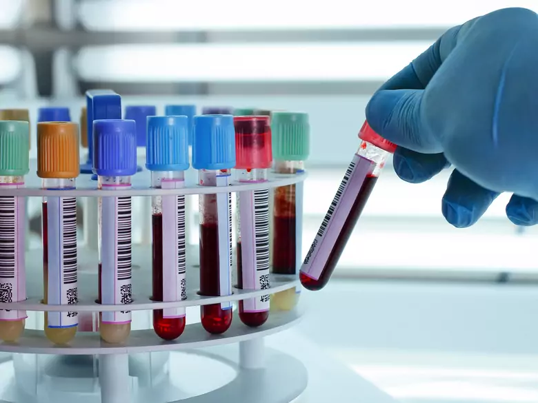 Wrzesień miesiącem Świadomości Nowotworów Krwi – gdzie szukać wiedzy na ich temat?