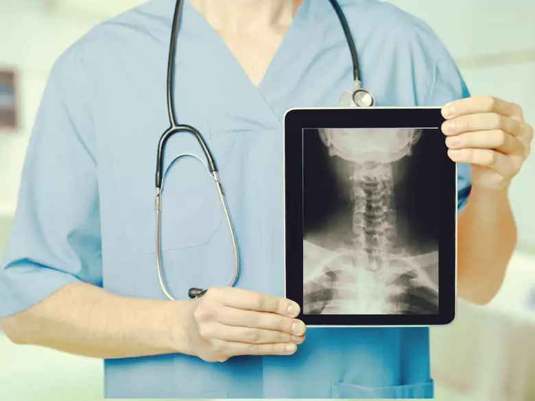 Nowotwory narządów głowy i szyi