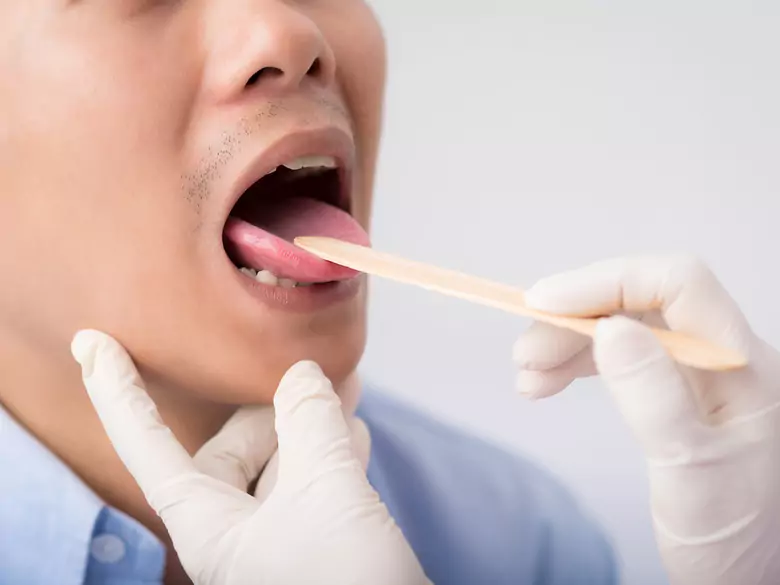 Rak gardła: jakie dolegliwości mogą nasuwać jego podejrzenie?