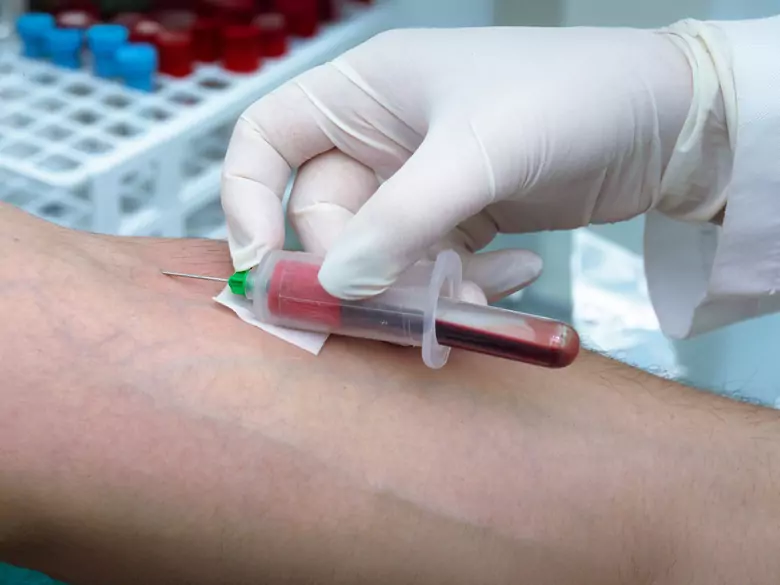 21 kwietnia - Światowy Dzień Świadomości Ostrej Białaczki Szpikowej (AML)