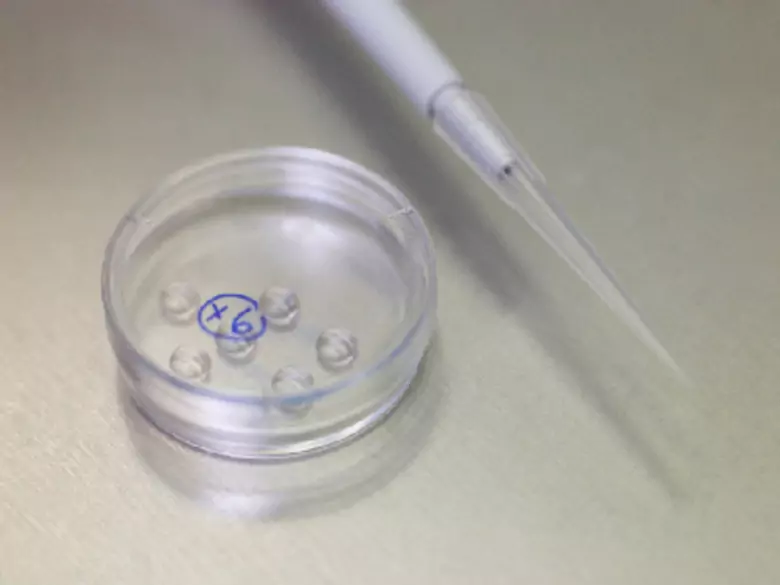 Prognozy zachorowalności i umieralności na nowotwory złośliwe w Polsce do 2025 roku