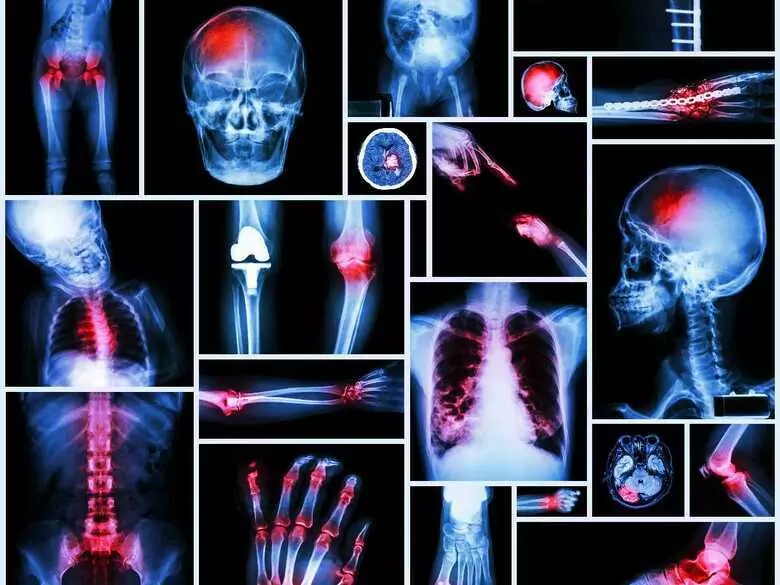Algorytmy kontra doświadczenie. Dlaczego lekarz wciąż jest najważniejszy w leczeniu dzieci z nowotworem?