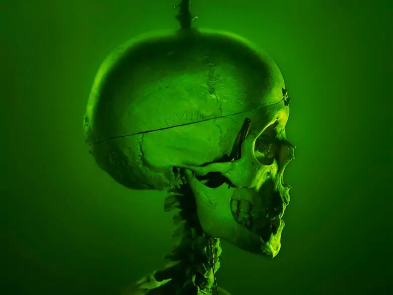 Czym jest kraniotomia i w jakich przypadkach się ją stosuje?