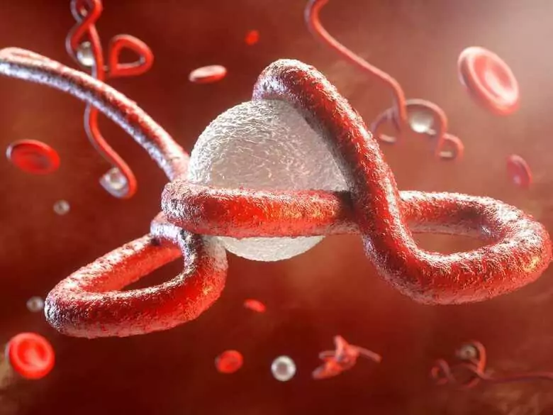 Pancytopenia, trombocytopenia i leukopenia – czym są i jak leczyć?