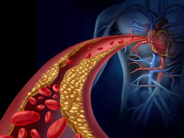 Czym są naczyniaki krwionośne?