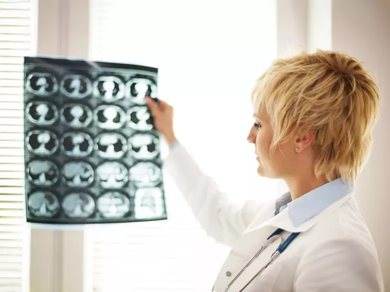 Zastosowanie litu w leczeniu zaburzeń czynności poznawczych po radioterapii